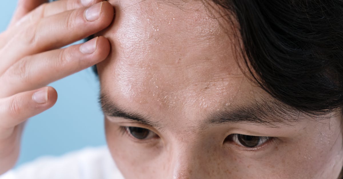 Quais são os problemas oculares comuns e seus sintomas?